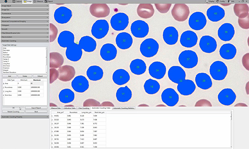 自動(dòng)計(jì)數(shù)功能