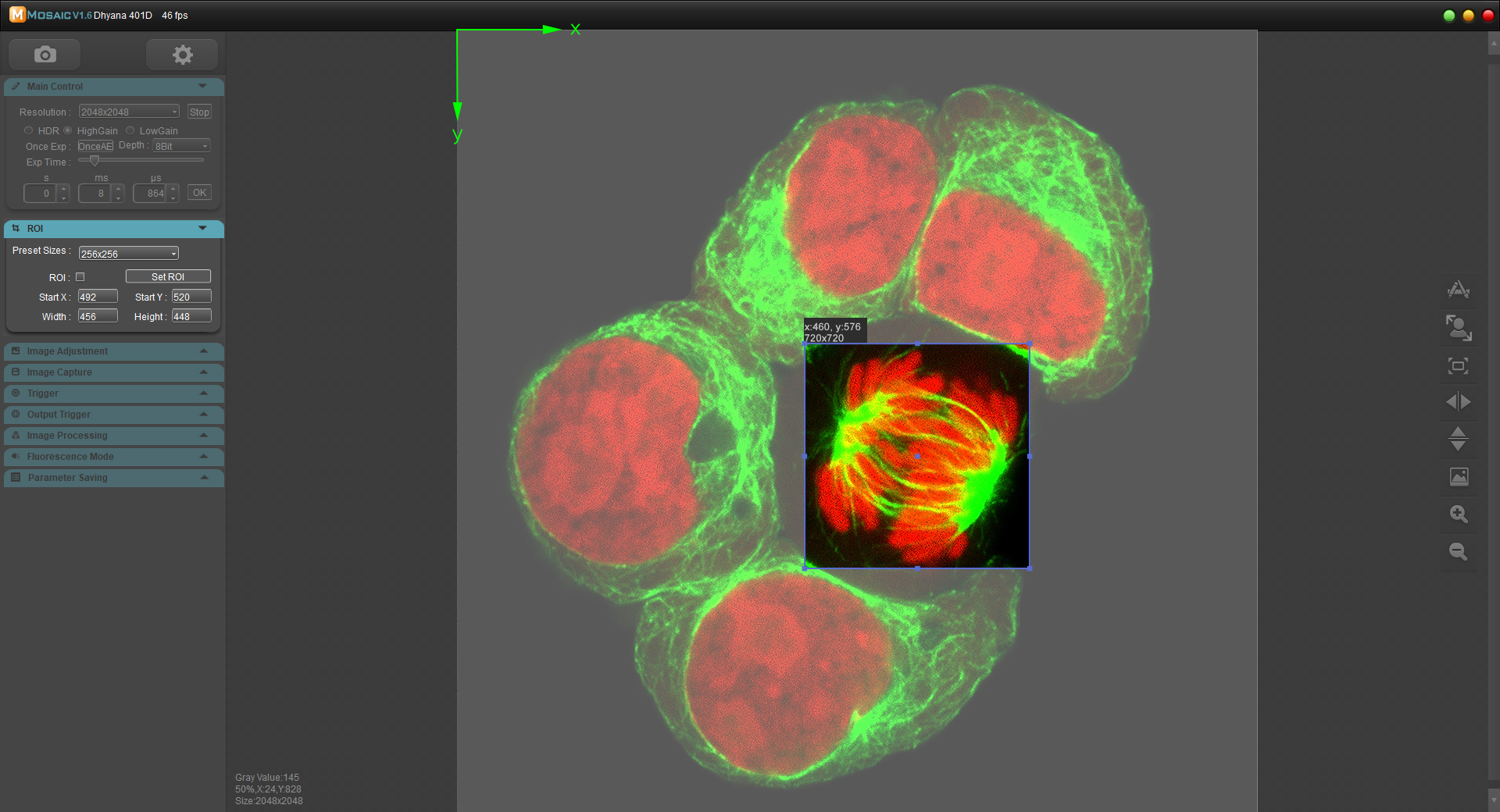 什么是感興趣區域（ROI）